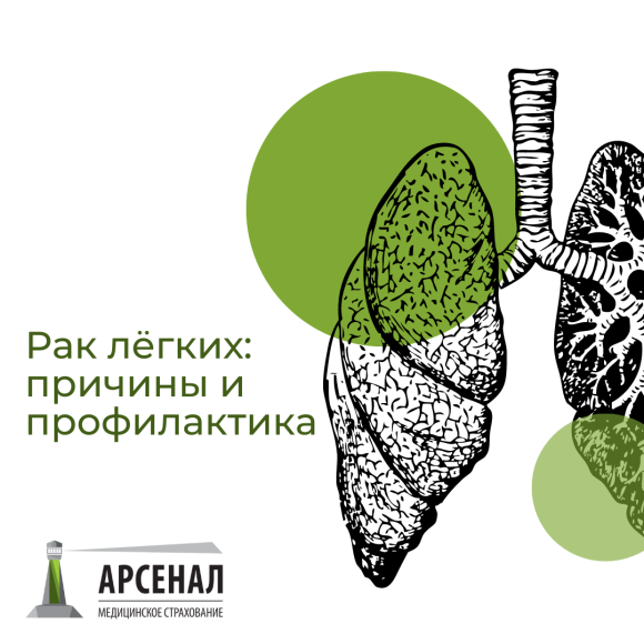 Рак лёгких: причины и профилактика